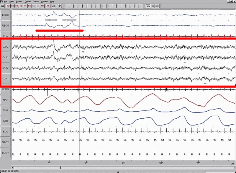 sleep eeg rem